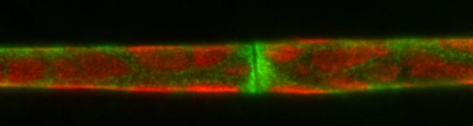 Growth Signaling in CMT1A Growth Signaling in CMT1A