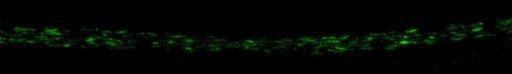Axon-glia metabolic coupling of peripheral nerves in a rodent model of Charcot-Marie-Tooth 1A (CMT1A) Axon-glia metabolic coupling of peripheral nerves in a rodent model of Charcot-Marie-Tooth 1A (CMT1A)