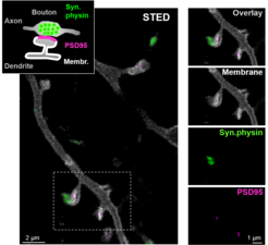 Figure 1: STED microscopy image from the brain of a living mouse. Cluster of synaptic vesicles in the presynapse (green), neuron with dendritic spines (white) and postsynaptic density (magenta).