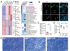 Fig 1: Perturbed lipid synthesis in CMT1A Schwann cells and therapeutic effect of dietary lipids. (A) By RNAseq analysis, sciatic nerves from CMT1A (Tg) rats at E21, P6 and P18 revealed a failure in the upregulation of lipid biosynthesis associated genes during primary myelination (Pattern 1, highlighted in magenta). (B) Myelinating DRG Schwann cell cocultures, supplemented with fluorescently labelled phosphatidyl choline (BODIPY-PC, top: green) or phosphatidic acid (BODIPY-L, bottom) show uptake of phosphatidylcholine into the myelin sheath (MBP, magenta). Cell nuclei are counterstained with DAPI (blue). (C) Myelination in DRG neuron Schwann cell cocultures is improved after phosphatidyl choline (PC) supplementation. (D, E) Treatment of CMT rats with a chow enriched in phospholipids (3% PL) resulted in improved myelination. From: Fledrich et al., 2018.