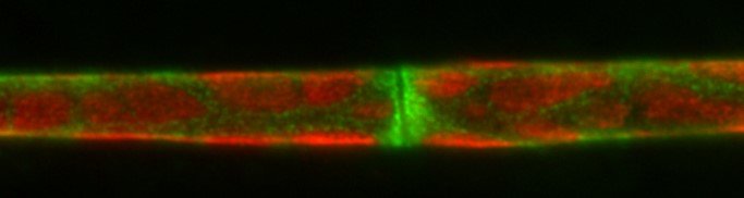 Growth Signaling in CMT1A
