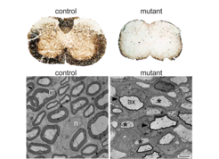 Fig. 2: Upper panel CNS. On cross sections of spinal cord stained for myelin (brown) young mutant are almost devoid of myelin, while control littermates show normal levels of myelin in white matter. Lower panel PNS. Electron micrograph of the sciatic nerve shows severe hypomyelination in conditional mutants.