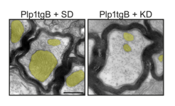 Fig. 1: Ketogenic diet (KD) rescues mitochondria enlargement and ameliorates impulse conduction in a mouse model of PMD (Plp1tgB).