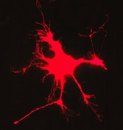 Fig. 4: Overexpression of recombinant Paralemmin-1 in fibroblasts induces the formation of branched cell processes and filopodia.