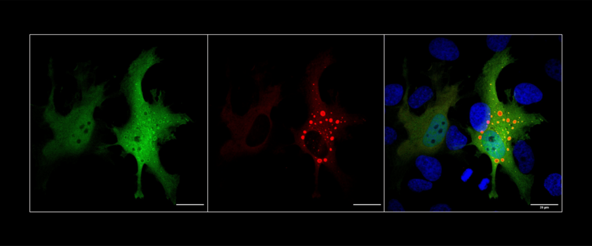 Experimental Neurodegeneration Experimental Neurodegeneration
