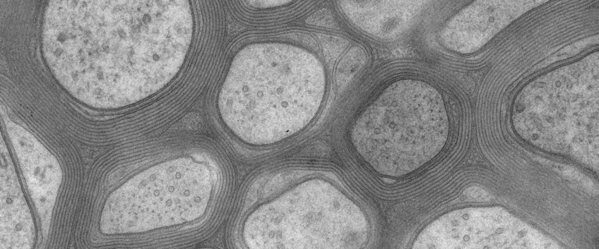 Neurogenetics Neurogenetics