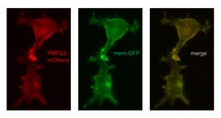 HEK cells expressing membrane anchored GFP (green) and PMP22-mCherry (red).