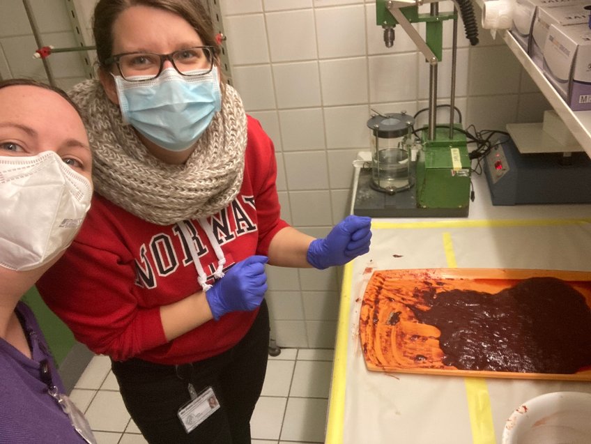 Liver Prep Liver Prep