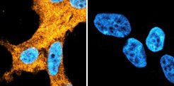 Die Abbildung zeigt eine Zelle mit übermäßigem Alpha-Synuclein (links) im Vergleich zu einer Zelle, in der das Alpha-Synuclein gentechnisch ausgeschaltet ist (rechts). Der Zellkern ist blau, das Protein Alpha-Synuclein gelb angefärbt.
