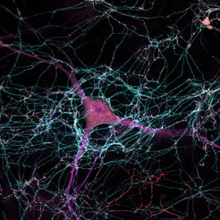 Der Zellkörper in der Mitte einer Dopamin-Nervenzelle und die astartigen empfangenden Nervenzellfortsätze sind in Magenta gezeigt, komplex verzweigte Axone in Hellblau und die für die Dopamin-Freisetzung verantwortlichen Axonbereiche in Rot.