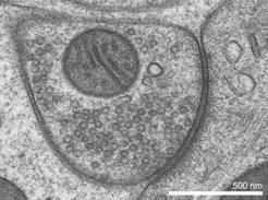 Die Abbildung zeigt eine elektronenmikroskopische Aufnahme einer hemmenden Synapse, über die die Nervenzelle in Kontakt zu einer anderen Zelle steht. Die zahlreichen synaptischen Vesikel mit einem Durchmesser von etwa 40 Nanometern werden vom molekularen Transporter VGAT mit dem GABA-Botenstoff befüllt.