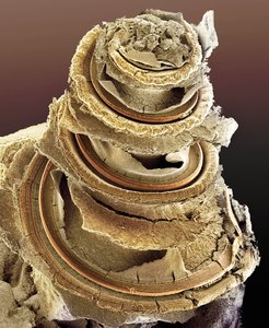 Die elektronenmikroskopische Aufnahme zeigt, warum die Cochlea auch als Hörschnecke bezeichnet wird. In ihren Windungen sitzen die Hörsinneszellen (orange; infolge des Präparationsverfahrens für diese Aufnahme sind die Membranen, welche die Cochlea-Gänge umgeben, teilweise zerrissen).