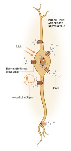 Damit eine Zelle des Hörnervs Lichtpulse wahrnehmen und die darin steckende Information über einen Höreindruck weitergeben kann, wird sie gentechnisch so verändert, dass sie lichtempfindliche Ionenkanäle produziert und in ihre Zellmembran einbaut. Die Kanäle lassen elektrisch geladene Atome hindurchströmen, wenn sie belichtet werden. Die einfließenden Ionen führen zur Bildung eines elektrischen Signals, das die Nervenzelle ins Gehirn weiterleitet.