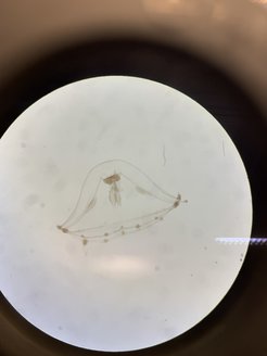 Transparent oogenesis: A jellyfish under the microscope.