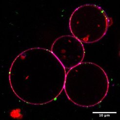 Fluorescent lipids were to see how the nanomachine accelerates lipid transfer when necessary.
