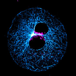 Eine Rinder-Eizelle kurz nach der Befruchtung: Das väterliche und mütterliche Erbgut liegt zunächst noch getrennt in zwei Vorkernen. Bevor es sich vereinigt, sammeln sich die Chromosomen (in magenta) an der Kontaktfläche der beiden Vorkerne. Blau gefärbt ist ein Teil des Zellskeletts. Hochauflösende fluoreszenzmikroskopische Aufnahme.