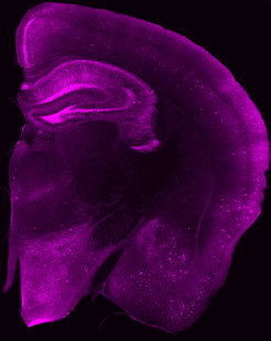Blick ins Gehirn einer Maus: In den magenta leuchtenden Bereichen haben sich Tau-Proteine angesammelt. In einigen Nervenzellen (helle Flecken) ist die Konzentration besonders hoch. Zum Teil sind die Fortsätze (Dendriten) der Nervenzellen zu erkennen.