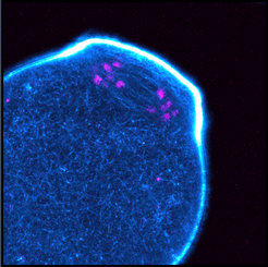 Aktin in der Spindel von Eizellen der Maus. Aktin ist blau, Chromosomen sind magenta gefärbt.