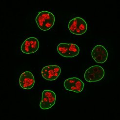 Mit Fluoreszenzfarbstoffen gekoppelte Sekundär-Nanobodies können entsprechende Sekundär-Antikörper in der Mikroskopie ersetzen. Gezeigt sind Krebszellen, bei denen Lamin A/C in grün und der Zellvermehrungsmarker Ki-67 in rot gefärbt wurden.
