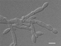 Die Hefe Ascoidea asiatica unter dem Mikroskop. Der Balken im Bild entspricht 5 Mikrometer (Millionstel Meter).