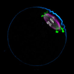 Eine Eizelle halbiert vor der Befruchtung ihren Chromosomensatz. Die Spindel (magenta) ordnet die Chromosomen (grau) dazu in einer Ebene an, bevor sie diese auf die beiden Spindelpole verteilt. Die neu entdeckte LISD (grün) organisiert die Spindel und stellt sicher, dass die Chromosomen fehlerfrei verteilt werden.