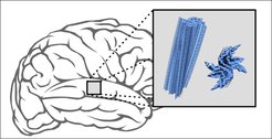 New insights into brain deseases:In Parkinson's and multisystem atrophy, proteins accumulate in layers to form elongated aggregates (blue) that are deposited in the brain. Researchers from Göttingen have analyzed the molecular structure of these protein deposits amplified from patients´ tissues. It turned out that the protein structures of patient-related aggregates differ from those of artificially aggregated protein and are surprisingly diverse in Parkinson's patients.