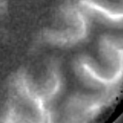 Slice #15, Magnified