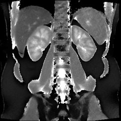 Liver & kidney