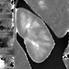 Magnification