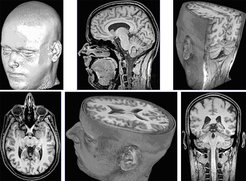 T1-weighted 3D FLASH MRI of the human brain at 0.8 mm isotropic resolution: surface reconstructions and cross-sectional images.