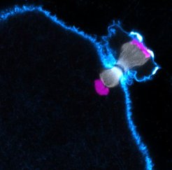 Chromosome segregation in a human egg cell