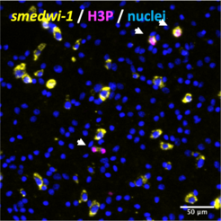 Dissociated cell preparation, stained for smedwi-1 mRNA (stem cell marker), phosphor-histone H3 (mitosis marker) and DAPI (nuclei).