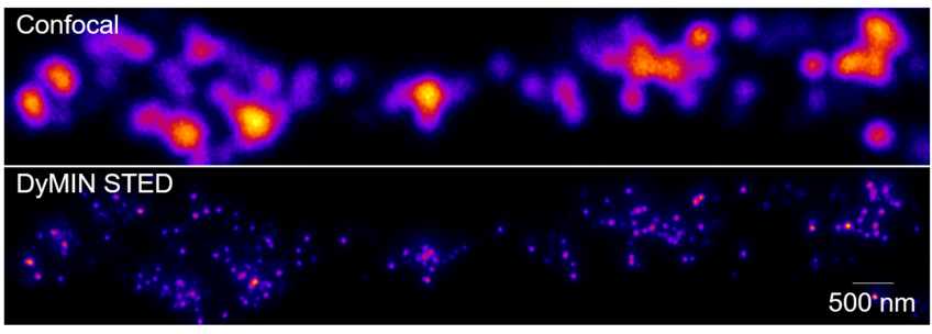 Synaptic Metal Ion Dynamics and Signaling Synaptic Metal Ion Dynamics and Signaling