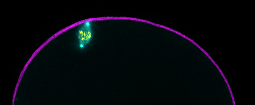 Cytoskeletal Dynamics in Oocytes