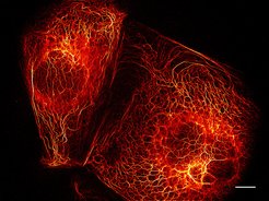 Live-cell imaging with parallelized RESOLFT nanoscopy. The image shows a RESOLFT recording of PtK2 cells expressing the fusion protein keratin 19–rsEGFP(N205S). The image is based on recording 144 frames, the total image acquisition time was on the order of a second. Scale bar: 10 μm.