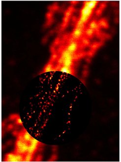 The STED microscopy (circular inset image) provides approximately ten times sharper details of filament structures within a nerve cell compared to a conventional light microscope (outer image).