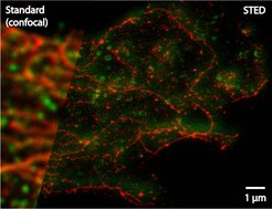 Two-color STED image of a glioblastoma, the most frequent malignant brain tumor in adults. Clathrin protein is green; ß-tubulin protein is stained red. In contrast to the blurred classical image (left), the STED image (right) shows considerably finer structures.