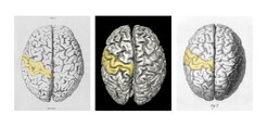 The brains of Carl Friedrich Gauss and Conrad Heinrich Fuchs side by side. Wagner's lithograph of Fuchs' brain from 1862 (left) and his copperplate of Gauss' brain from 1860 (right) show clear differences. The middle image is a recent MRI surface reconstruction of Gauss' brain. The central sulcus in the left half of each brain is highlighted in yellow.