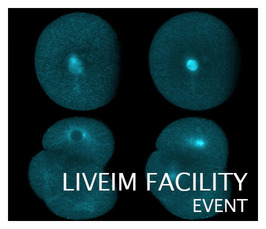 Liveim Facility Event: Structure Illumination Imaging Workshop 03.03 - 13.03.2020