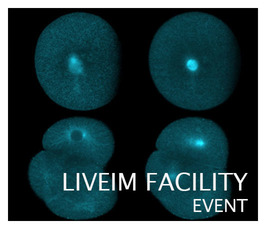 Liveim Facility Event: ImageJ Macro Programming Liveim Facility Event: ImageJ Macro Programming