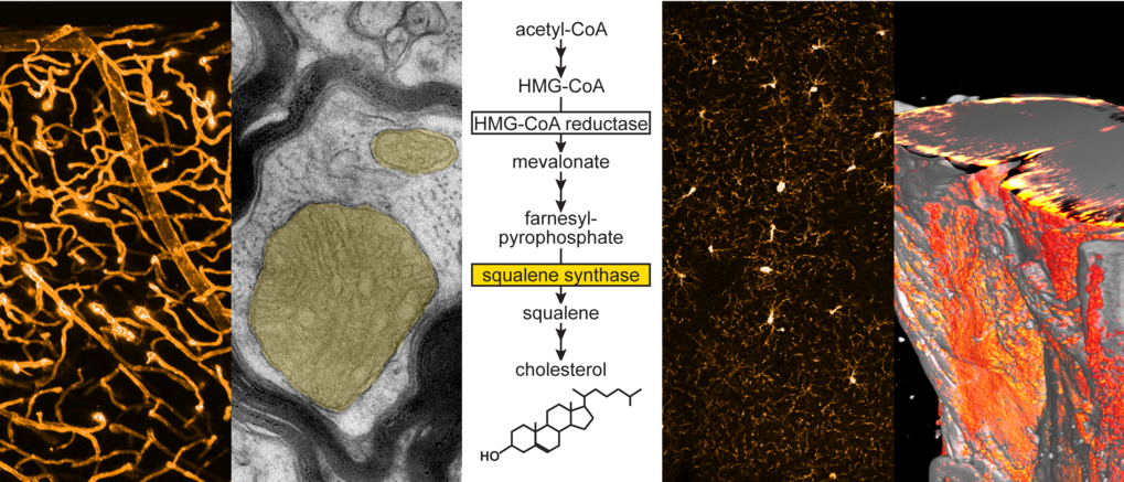 Lipid Metabolism